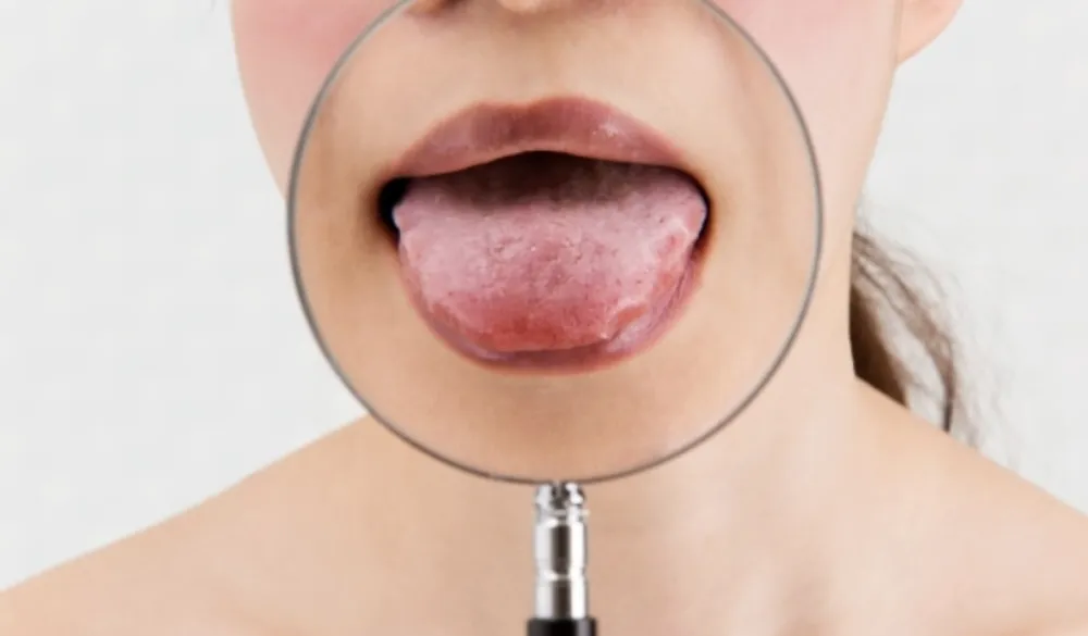 Nedostatak vitamina B12 može dovesti do ozbiljnih stanja