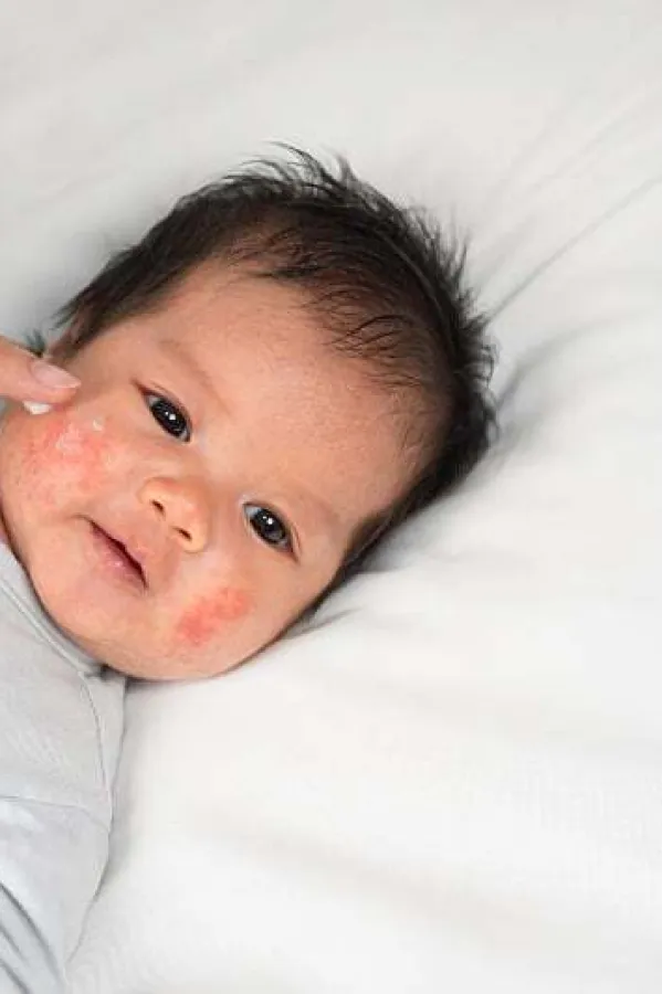 Kako pravilno njegovati bebinu kožu tokom zimskih mjeseci