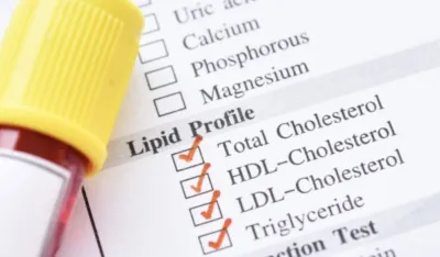 Jedna jutarnja navika može da povisi holesterol