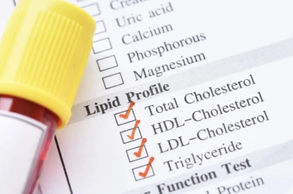 Jedna jutarnja navika može da povisi holesterol