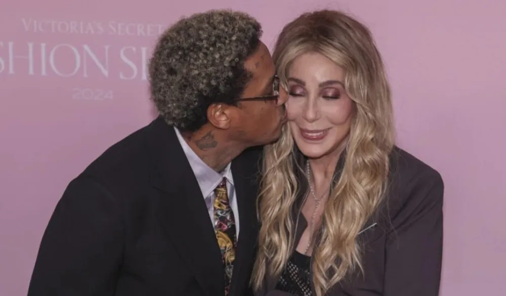 (VIDEO) &Scaron;er veza sa 40 godina mlađim "ispeglala" lice