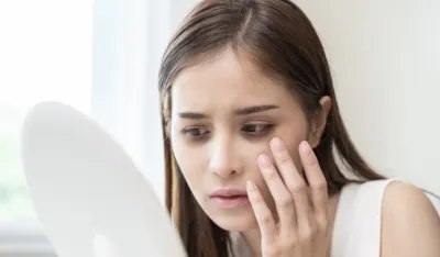 Podočnjaci nakon praznika: Sedam&nbsp;prirodnih i brzih re&scaron;enja da ih uklonite