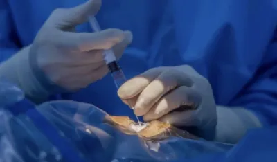 Revolucionarna injekcija gela u oko: Nada za hiljade ljudi&nbsp;