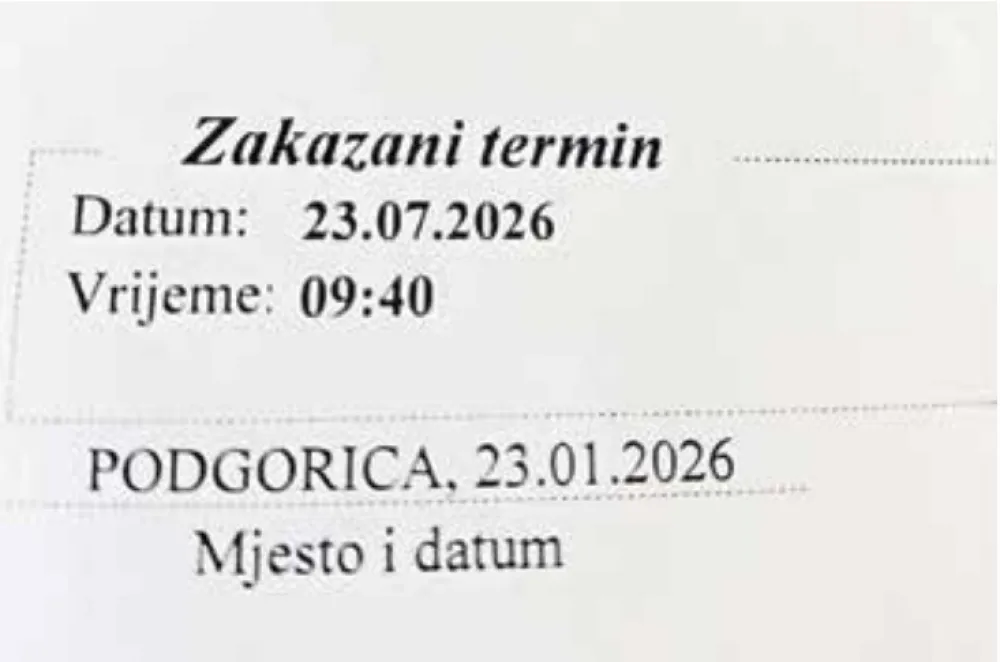 U KCCG pola godine se čeka na dopler krvnih sudova