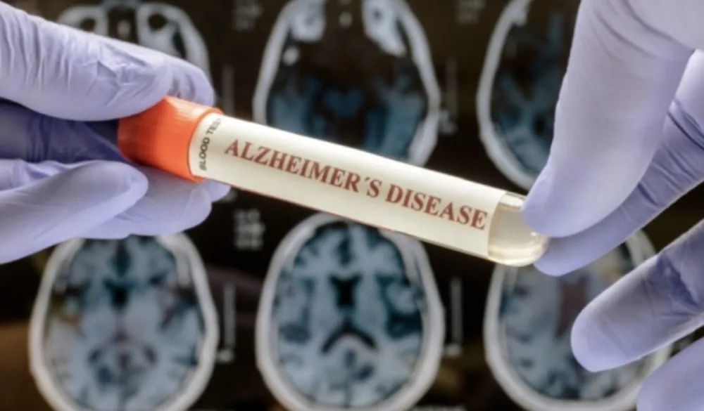 Izvor kome smo svi izloženi povećava rizik od Alchajmerove bolesti