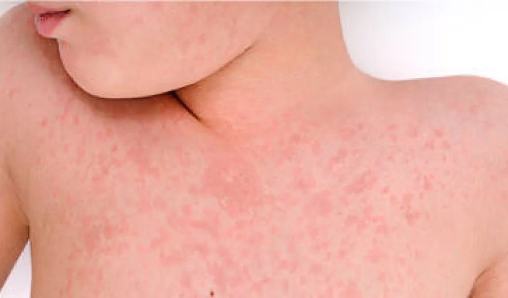 Udruženje "Roditelji" uputilo je inicijativu Ustavnom sudu: Povrijeđena prava i najbolji interes djeteta