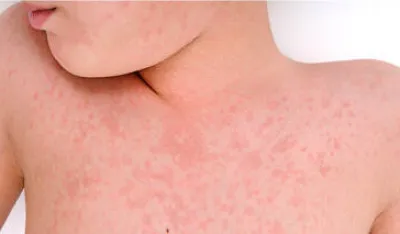 Udruženje "Roditelji" uputilo je inicijativu Ustavnom sudu: Povrijeđena prava i najbolji interes djeteta