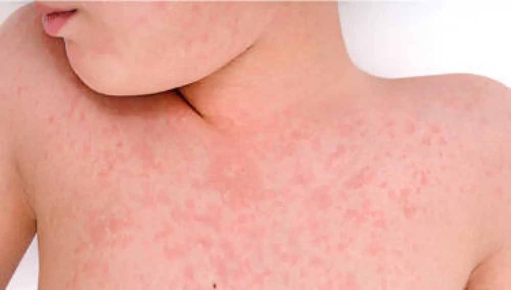 Udruženje "Roditelji" uputilo je inicijativu Ustavnom sudu: Povrijeđena prava i najbolji interes djeteta