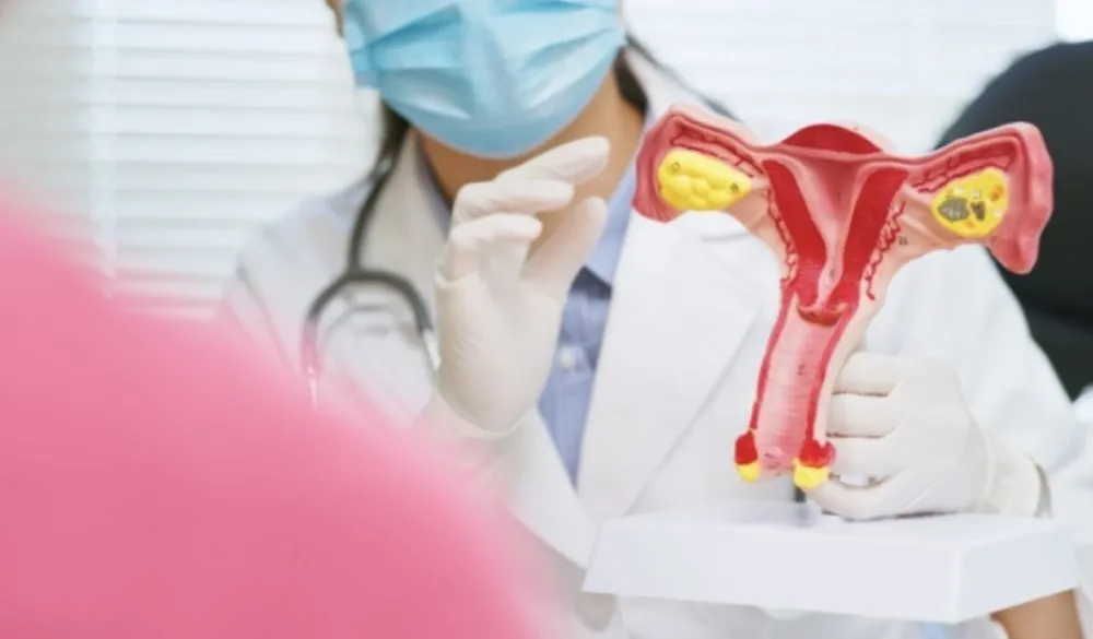 Naučnici razvili medicinski tampon koji može da otkrije rane znakove raka jajnika