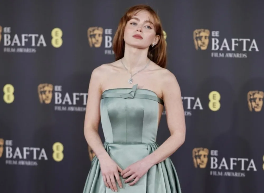 Čak i od rijetke kose pravi čuda: Frizura iz pro&scaron;losti je ponovo hit&nbsp;