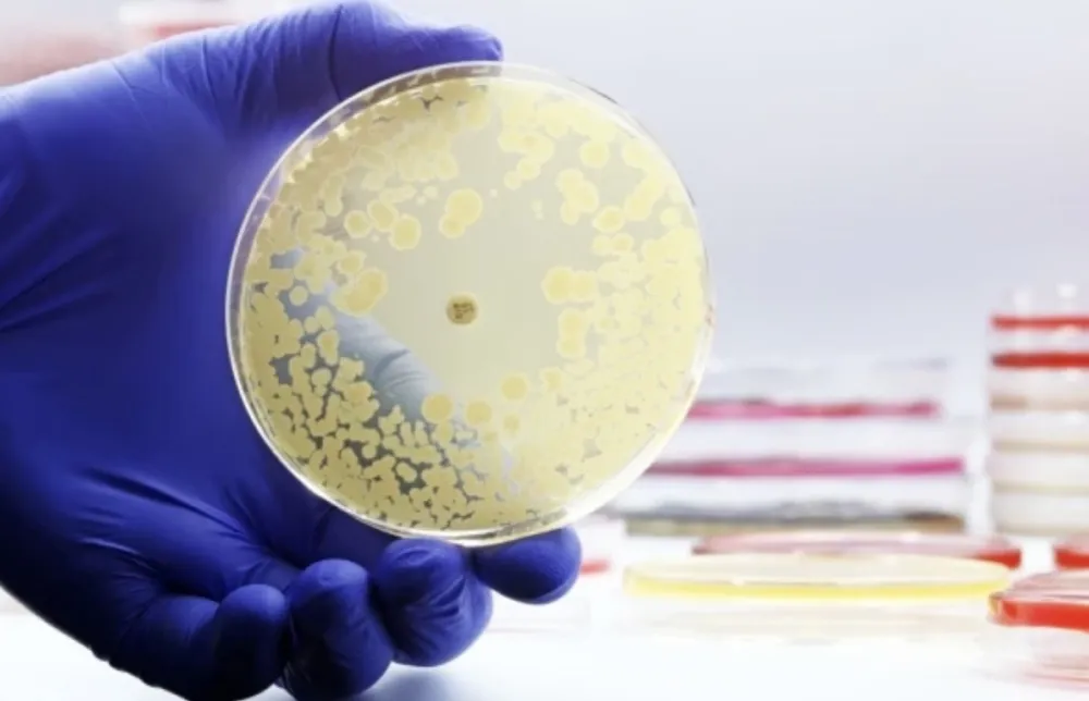 Gori nego &scaron;to se mislilo: Dejstvo antibiotika &scaron;tetno i do osam godina