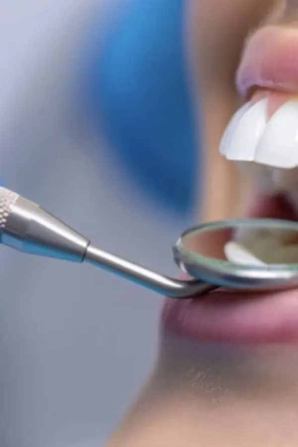 Rusi sproveli veliku studiju: Ovaj vitamin je ključan za zubnu implantaciju