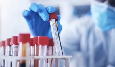 Ovo oboljenje je najče&scaron;ći uzrok srčanog i moždanog udara