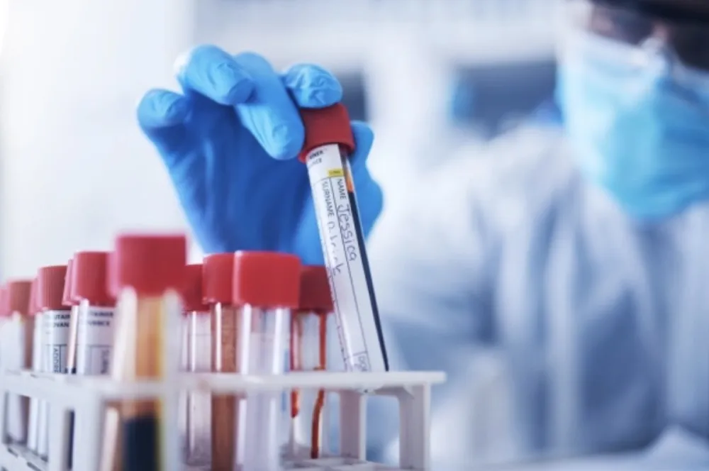 Ovo oboljenje je najče&scaron;ći uzrok srčanog i moždanog udara