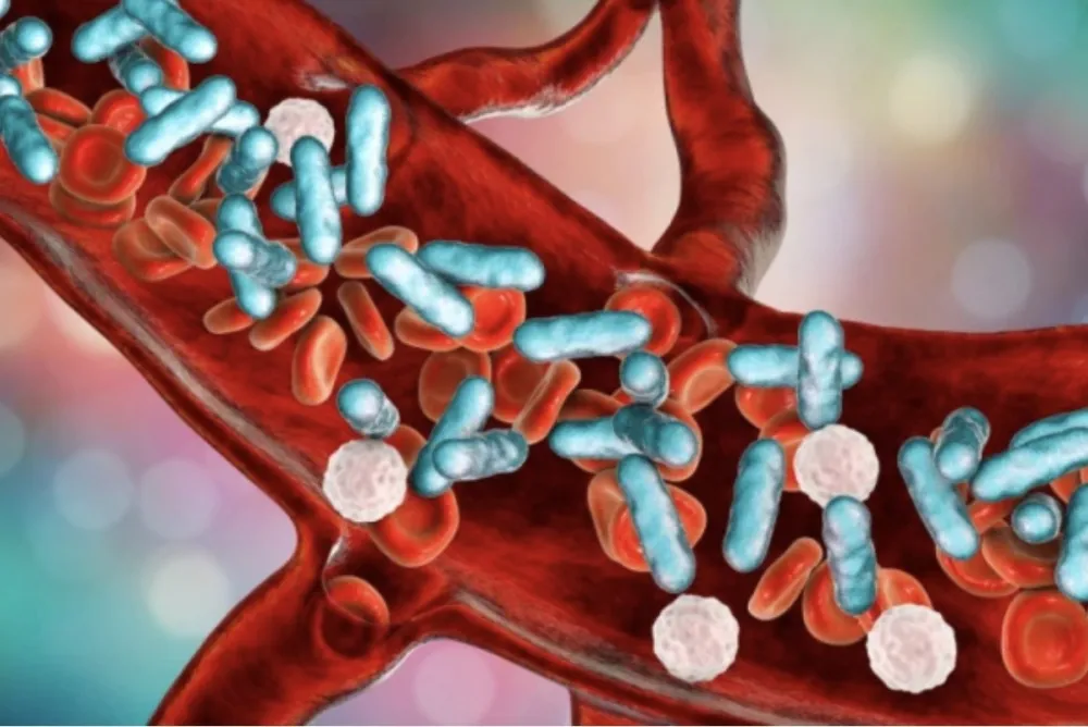 Nova kombinovana terapija mogla bi da liječi agresivnu leukemiju, otkrivaju naučnici