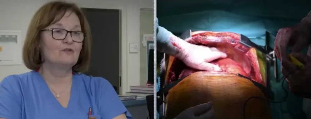 Prva transplatacija pluća u Srbiji