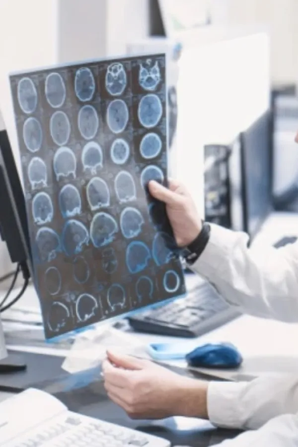 Hobi koji menja mozak iz korijena: Neurolog otkriva &scaron;ta najvi&scaron;e jača kognitivne fukcije