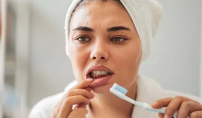 Desni vam često krvave? Nedostatak ovog vitamina može biti uzrok