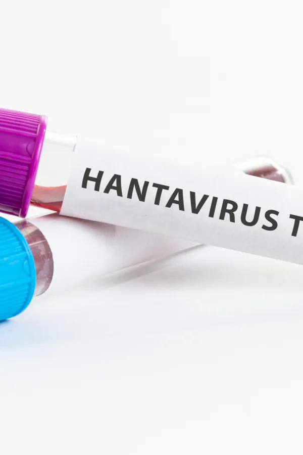 Preminule tri osobe na kruzeru, sumnja se na hanta virus