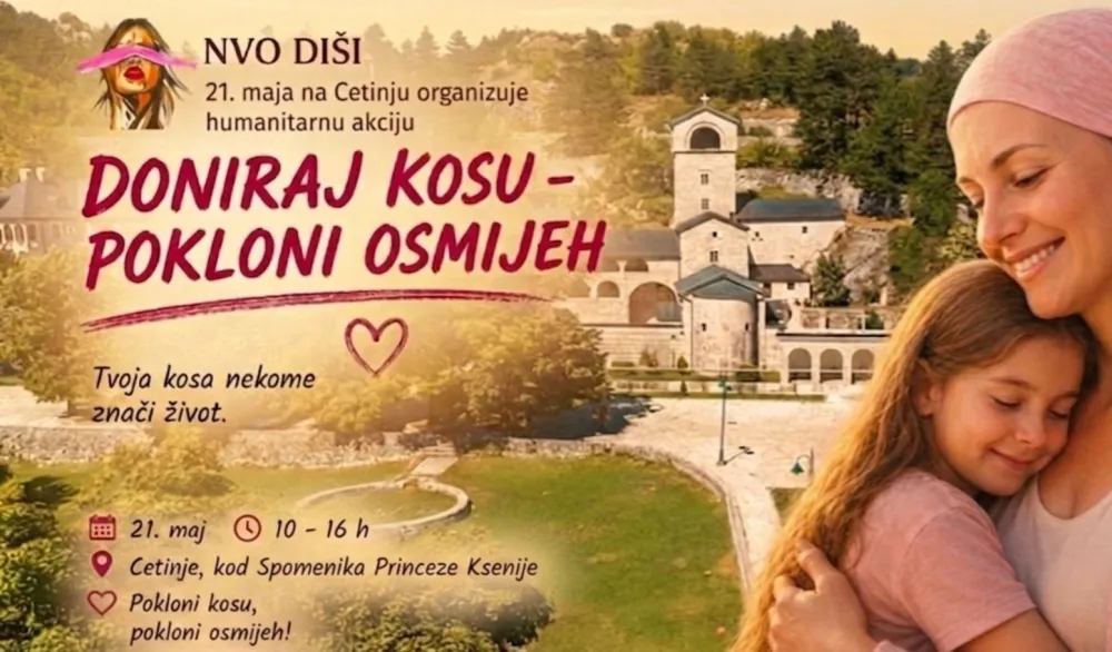 NVO DI&scaron;i - doniraj kosu