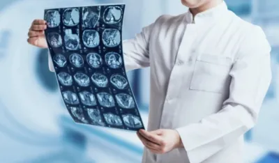 Nova nada za liječenje glioblastoma: Otkriven "prekidač" koji pokreće najopasniji tumor mozga