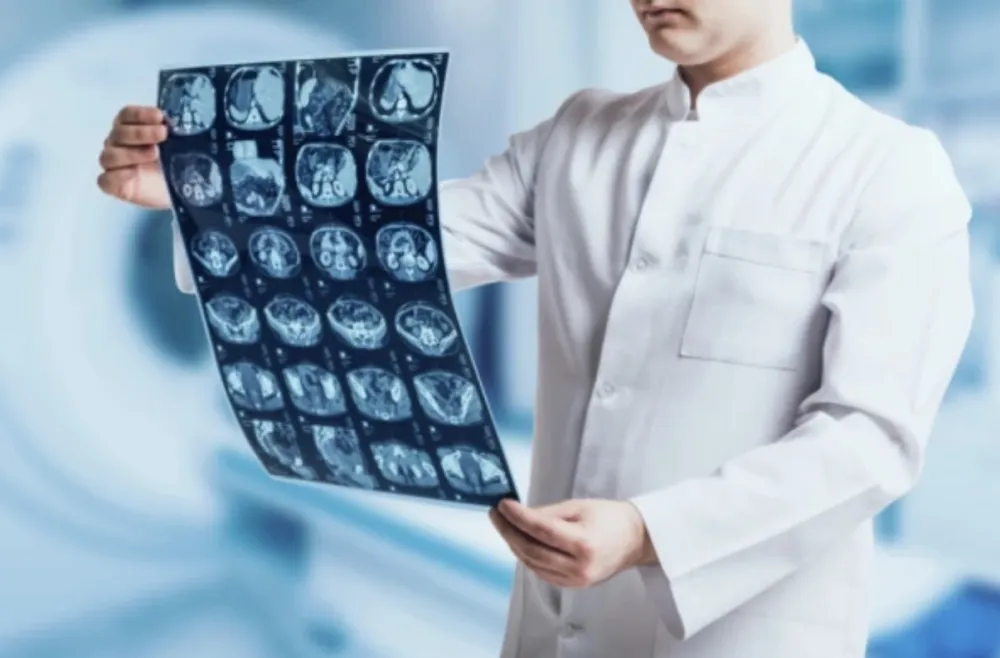 Nova nada za liječenje glioblastoma: Otkriven "prekidač" koji pokreće najopasniji tumor mozga