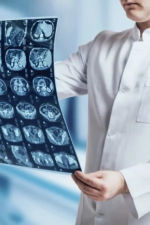 Nova nada za liječenje glioblastoma: Otkriven "prekidač" koji pokreće najopasniji tumor mozga