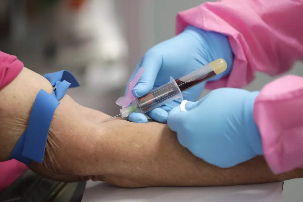 Prvi slučaj infekcije virusom zika u Sjevernoj Makedoniji