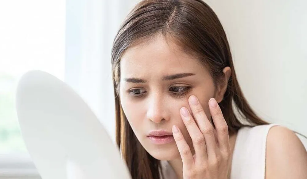 Nedostatak ovih vitamina može uzrokovati tamne krugove ispod očiju