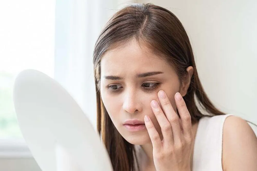 Nedostatak ovih vitamina može uzrokovati tamne krugove ispod očiju
