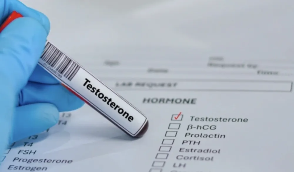 Nivo testosterona kod mu&scaron;karaca se prepolovio: Najniži u poslednjih pet decenija