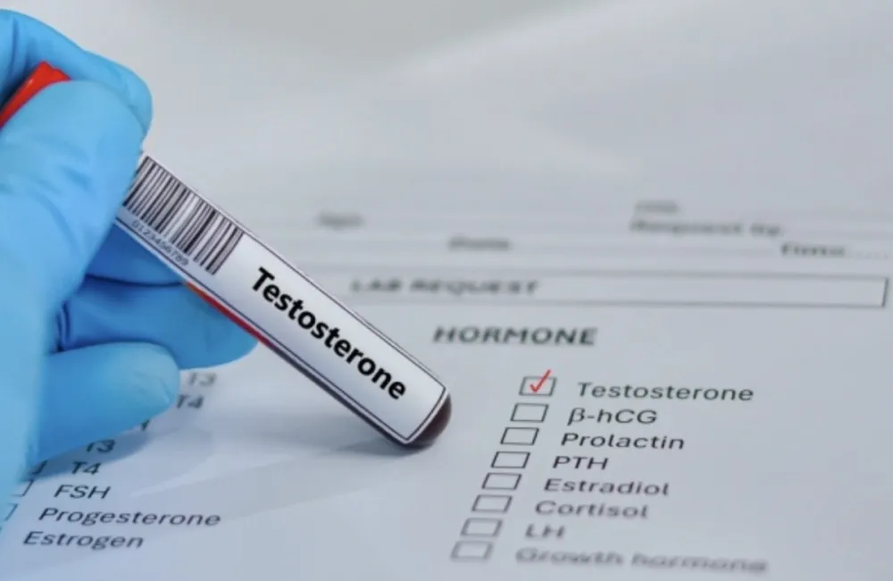 Nivo testosterona kod mu&scaron;karaca se prepolovio: Najniži u poslednjih pet decenija