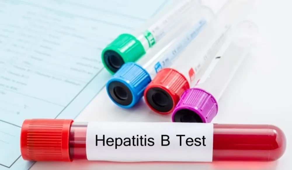 Svjetski dan borbe protiv hepatitisa - bolest često ne daje simptome