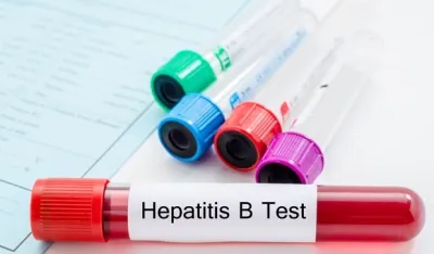 Svjetski dan borbe protiv hepatitisa - bolest često ne daje simptome