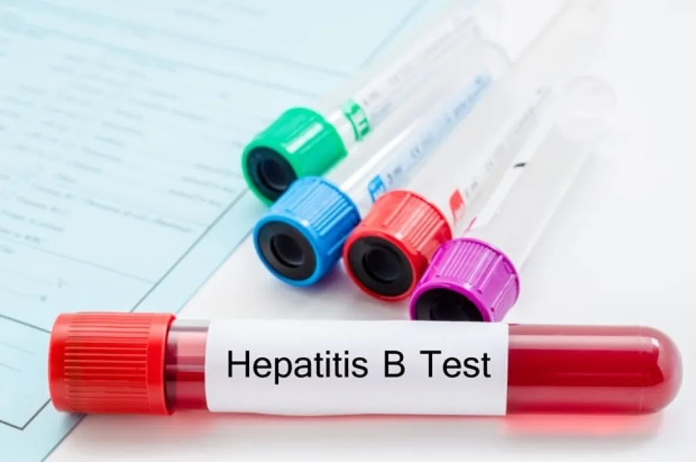 Svjetski dan borbe protiv hepatitisa - bolest često ne daje simptome