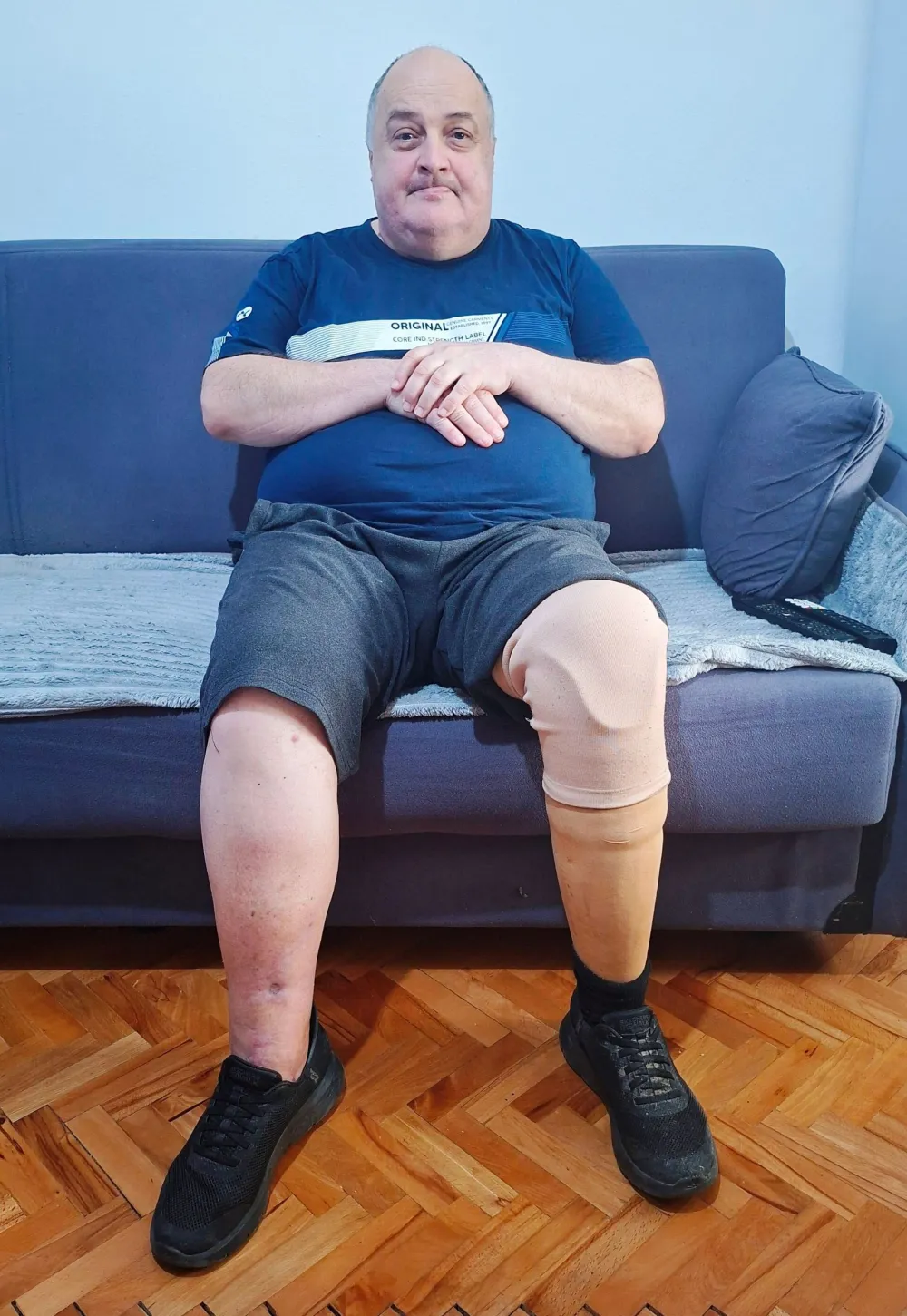 Poznati nik&scaron;ićki taksista ostao bez noge, nema&nbsp;penziju, živi od 100 eura tuđe njege