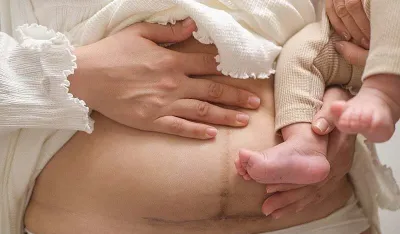 Ishrana nakon carskog reza važna je za oporavak: Ovo su namirnice koje se preporučuju porodiljama