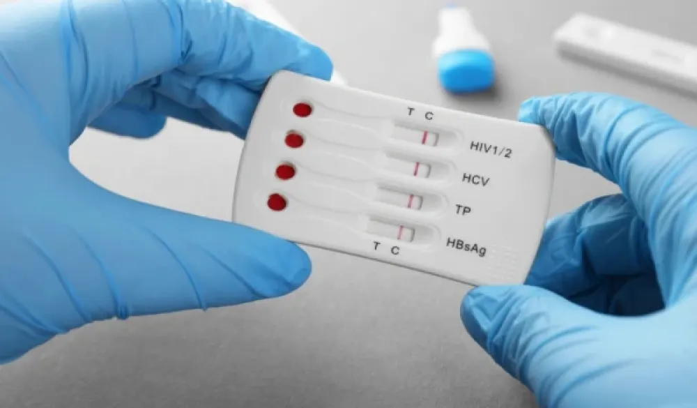 Veliki korak u borbi protiv HIV-a: Novi materijal ruskih naučnika smanjio virus 100.000 puta